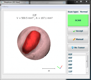 Measured tumor image from TumorImager 2 scan
